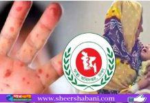 দেশে আরও ১৭ শিশুর মৃত্যু, আক্রান্ত ১,২২৪
