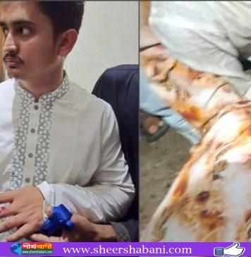 হবিগঞ্জে হামলায় আহত সারজিস